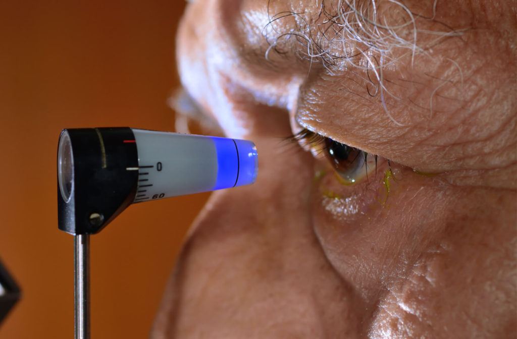 An elderly man is undergoing a tonometry test from his optometrist to check eye health and the risk of glaucoma.